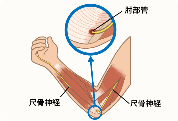 イメージ画像