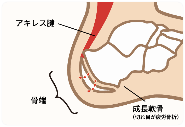 イメージ画像