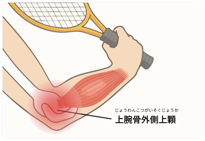 イメージ画像
